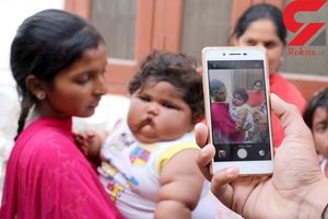 سنگین ترین دختر بچه 8 ماهه در هند