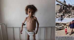  تصاویر وحشتناک توئیتر CNN از یمن