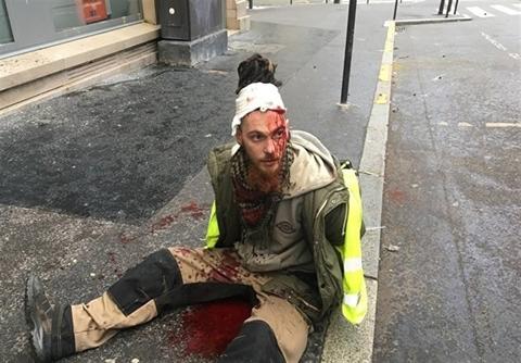 ۳۰ زخمی در درگیری پلیس با جلیقه زردها +عکس