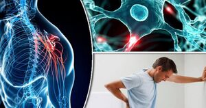 بیماری ام اس