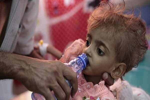 هشدار سازمان ملل در خصوص بروز قحطی در یمن