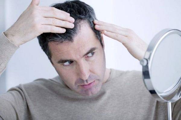 ریزش موی ناشی از ویروس کرونا,ریزش مو بر اثر کرونا