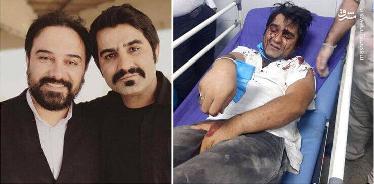 حمله خونین به ۲ بازیگر سریال دودکش +عکس