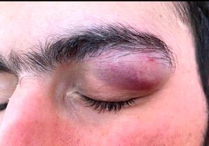 حمله با چاقو به چشمان یک پزشک در بندرعباس +عکس