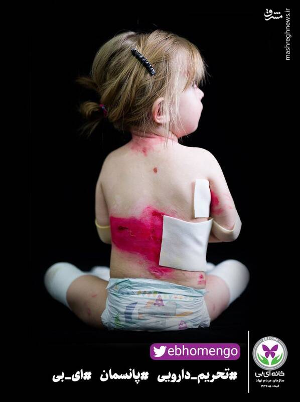 ظلم یعنی جدال نابرابر زخمهای ای بی با تحریم دارویی+عکس