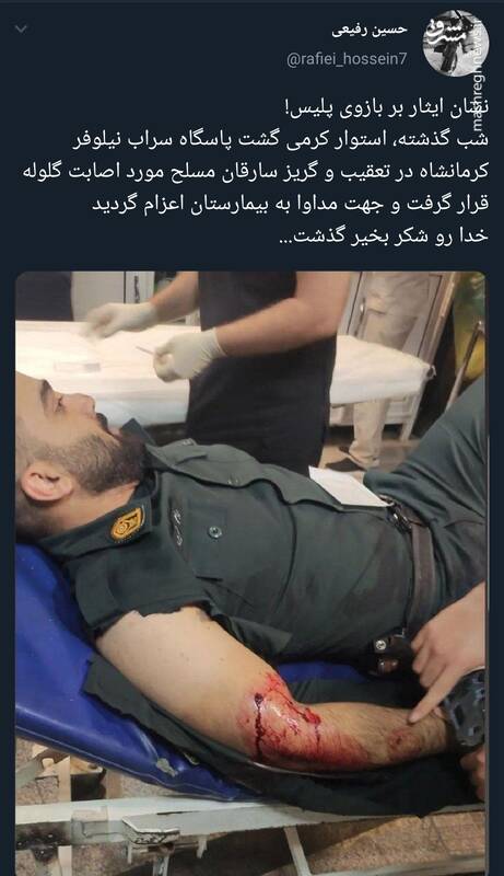 گلولهای که نشان ایثار بر بازوی این پلیس شد!+عکس