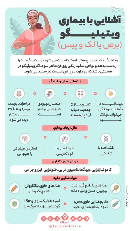 آشنایی با بیماری لک و پیس