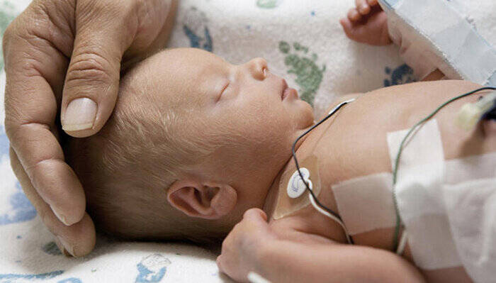 سزارین؛ آبستن عوارض