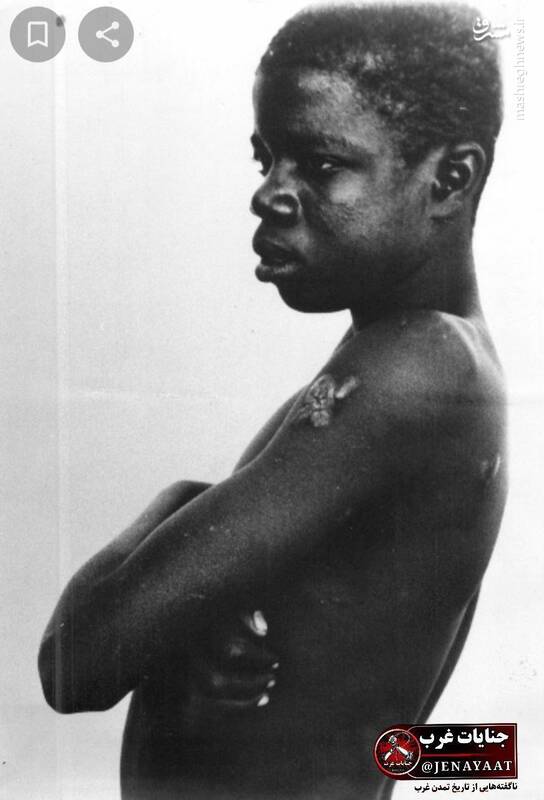 اگر تلاش خبرنگاران نبود، این جنایت برای همیشه در تاریخ دفن میشد+عکس