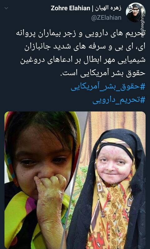 مهر ابطالی بر ادعاهای دروغین حقوق بشر آمریکایی