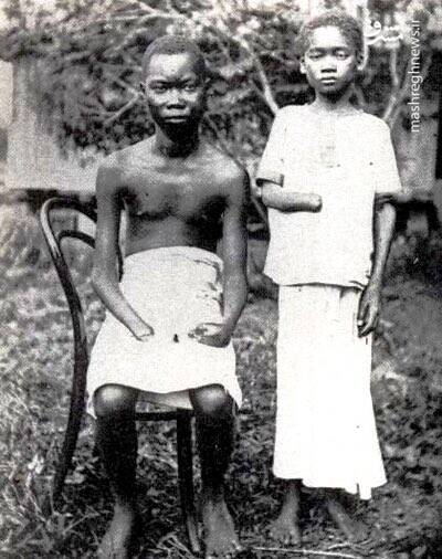 قطع دست کودکان، بخشی از جنایات استعمارگران بلژیک است