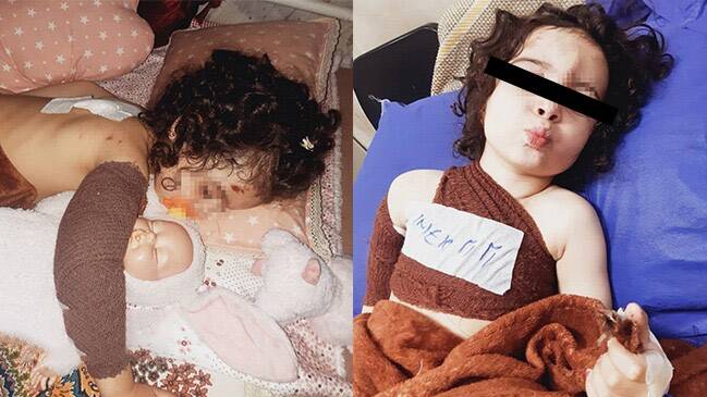 سگهای بچه کش! / ولگردهایی که طعمههایشان کودکان هستند