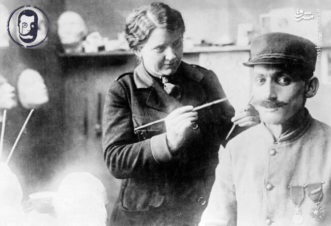 روزگاری که جراحی زیبایی مد نبود +عکس