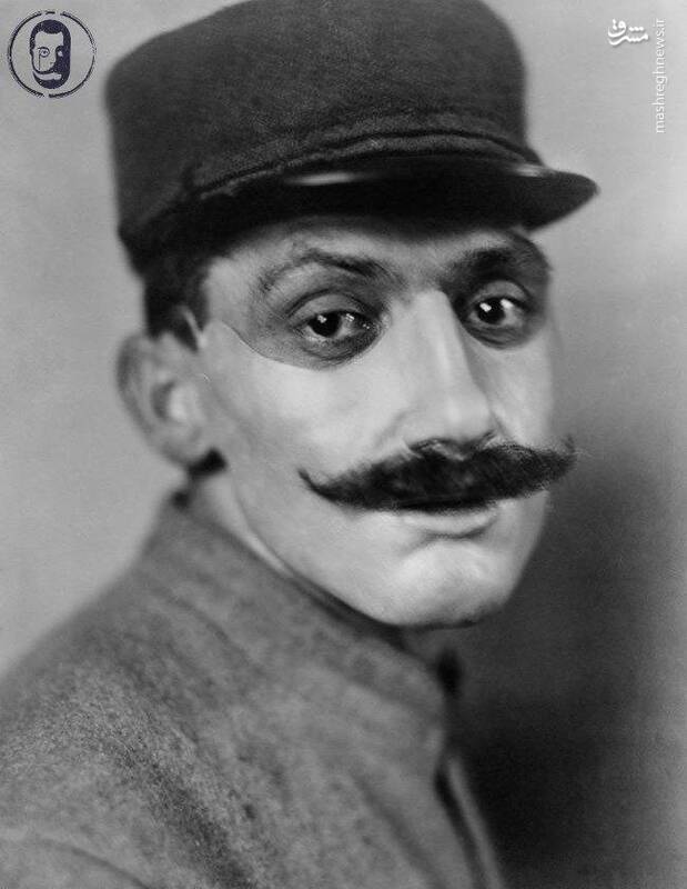 روزگاری که جراحی زیبایی مد نبود +عکس