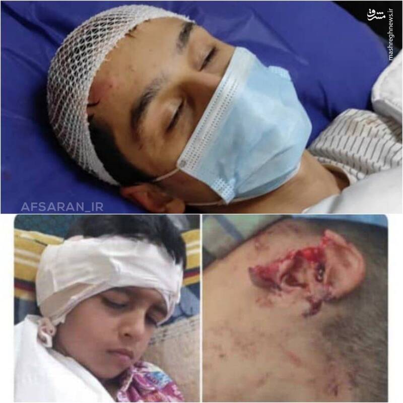 قربانیان دیروز و امروز سگ ها در کشور +عکس