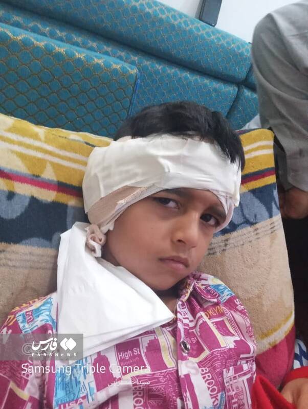 ماجرای حمله سگهای ولگرد به کودک پنج ساله/ گوشتِ گوش پسرم پیوند داده نشد/فاصله دندان سگ با رگ گردن حامد فقط یک سانتیمتر بود