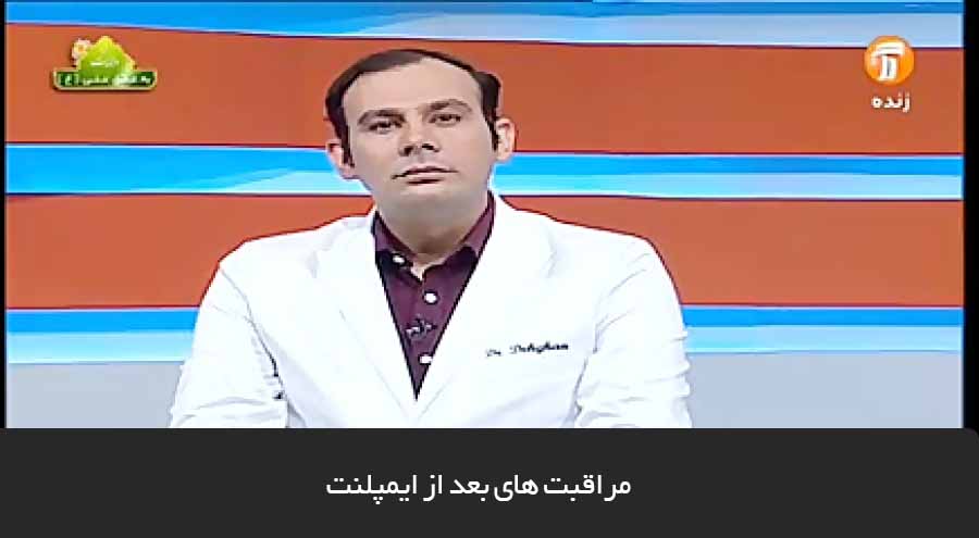 راهنمای کامل مراقبت های بعد از ایمپلنت دندان