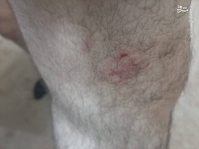 حمله سگهای خانگی به مامور اورژانس +عکس