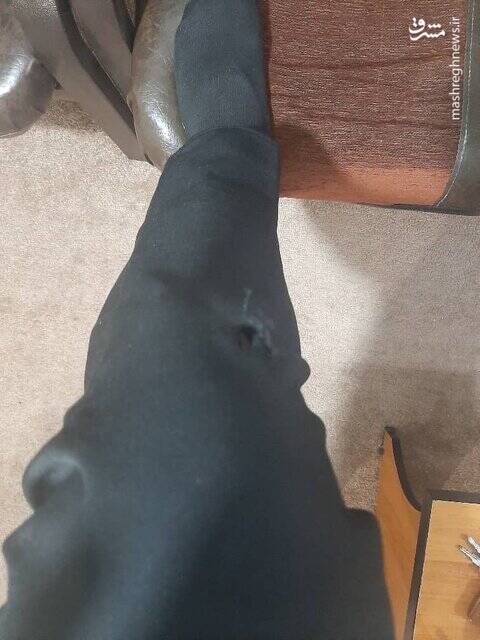 حمله سگهای خانگی به مامور اورژانس +عکس