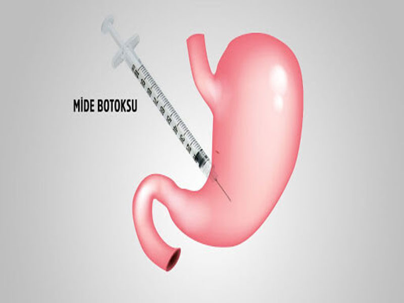 آیا بوتاکس معده در لاغری تاثیر دارد؟