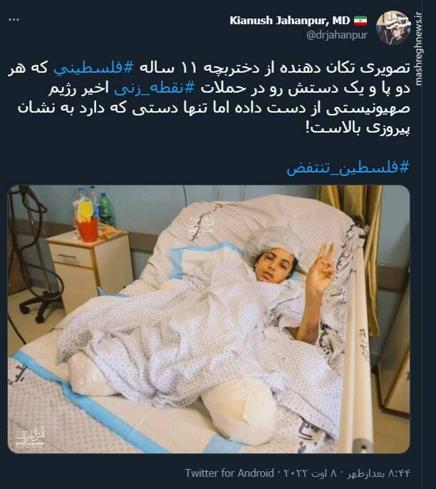 تصویری تکان دهنده از دختربچه فلسطینی پس از حمله اسرائیل