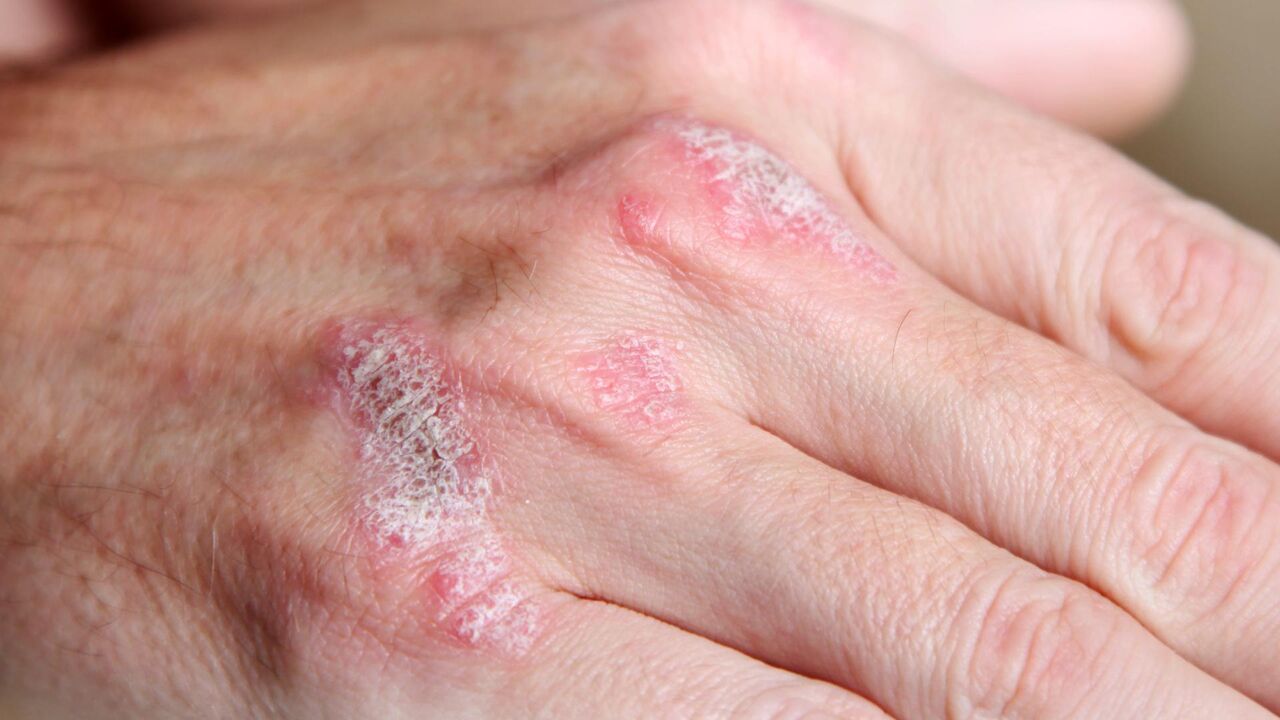 چه ویتامین هایی برای زیبایی و سلامتی پوست مفید هستند؟