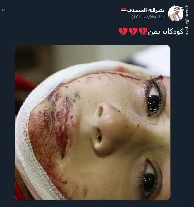 تصویری دردناک از کودکان یمن