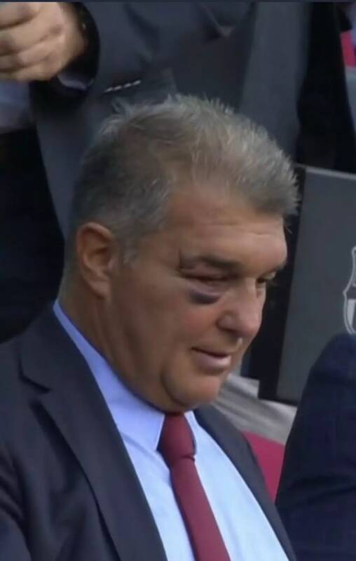 چشم کبود رئیس بارسا خبرساز شد