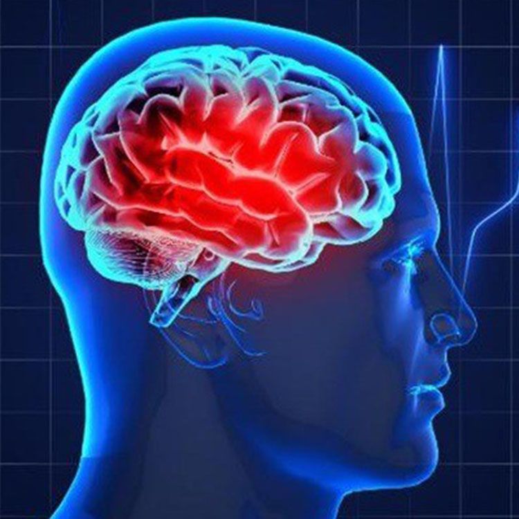 شایع ترین بیماری مغز و اعصاب