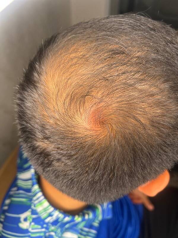 جراحت گلر پیکان پس از گل مردود استقلال +عکس