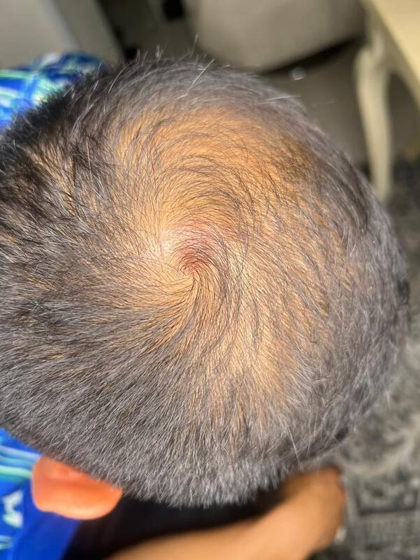 جراحت گلر پیکان پس از گل مردود استقلال +عکس