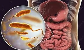 مهمترین نشانه ابتلا به بیماری وبا وبا