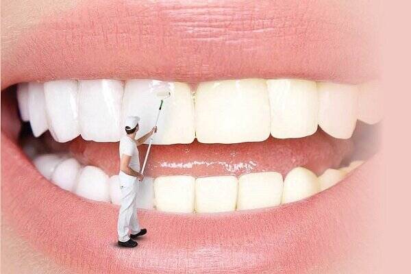 علت جرم گرفتن دندان چیست؟