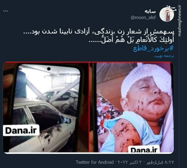 سهمش از شعار "زن ،زندگی، آزادی" نابینا شدن بود+ عکس