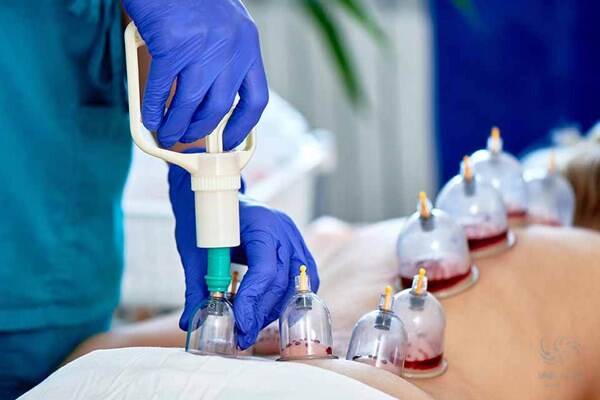 شرایط حجامت در فصل پاییز چیست؟ 2