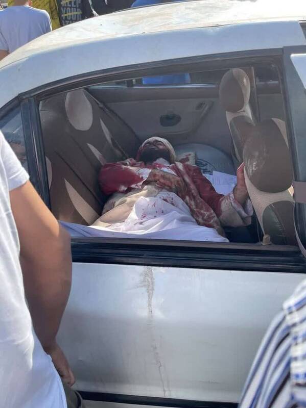 جزئیاتی از حمله اغتشاشگران با ۱۲ ضربه چاقو به روحانی کرجی+عکس