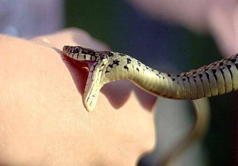 درمانهای اولیه مارگزیدگی را بشناسید