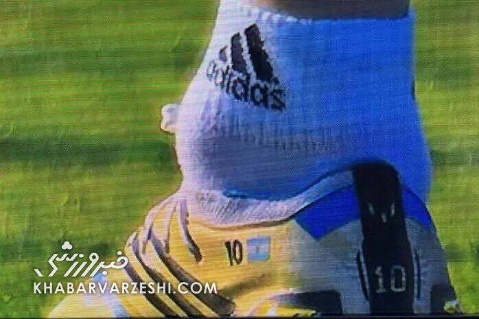 عکس| مصدومیت نگرانکننده مسی/ فوقستاره آرژانتینی به بازی نخست جامجهانی نمیرسد؟