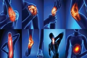 راههایی جالب برای تسکین درد آرتروز