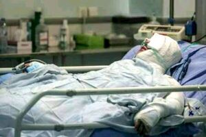 سوختگی مرد 40 ساله در حادثه انفجار کپسول گاز در دولت آباد