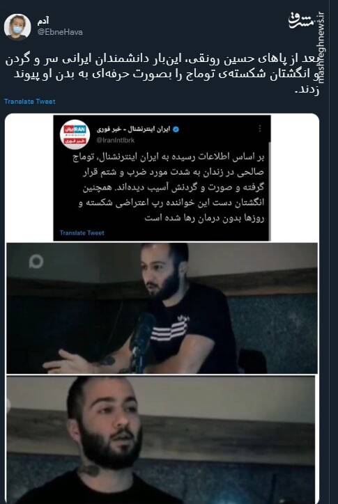 عمل موفق پیوند سر و گردن به توماج صالحی+ عکس