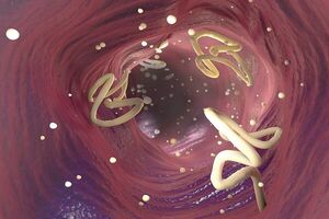 سرطان با پیری جمعیت رو به افزایش است