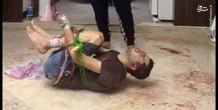 آدم ربایان ۸ روز فیتیلهپیچ گروگان را شلاق زدند +عکس