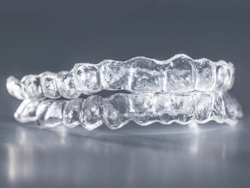 چه کسانی باید ارتودنسی دندان انجام دهند؟