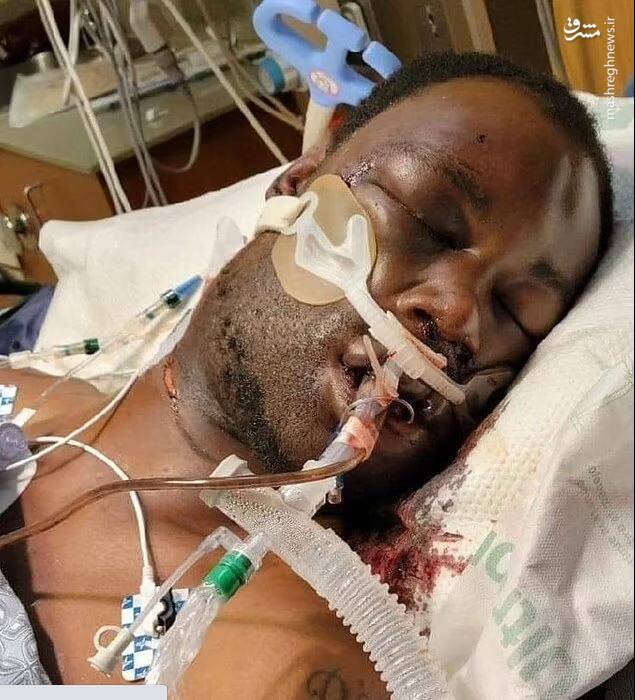 عکس/ نتیجه اعمال قانون توسط پلیس آمریکا