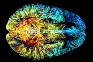 چگونگی کاهش التهاب مغز ناشی از افسردگی