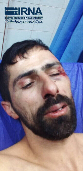 حمله اراذل و اوباش به ملیپوش المپیکی اسکی +عکس