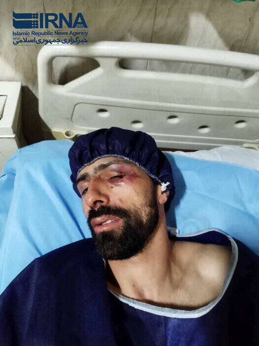 حمله اراذل و اوباش به ملیپوش المپیکی اسکی +عکس