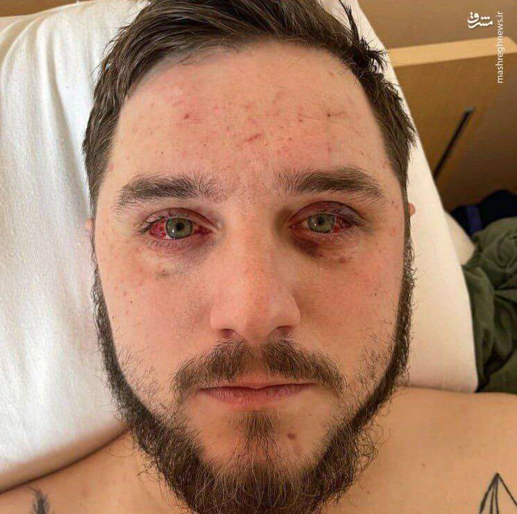 ارتش روسیه برای یک حمله سراسری جدید به اوکراین آماده میشود/ سقوط جنگنده اوکراینی در تلاش برای رهگیری "گل شمعدانی"/ صدها دستگاه زرهپوش امریکایی در آستانه انتقال به اوکراین +نقشه و تصاویر