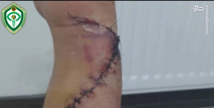 عربدهکشی اراذل به خون کشید +عکس